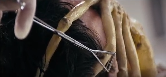 フェイスハガー