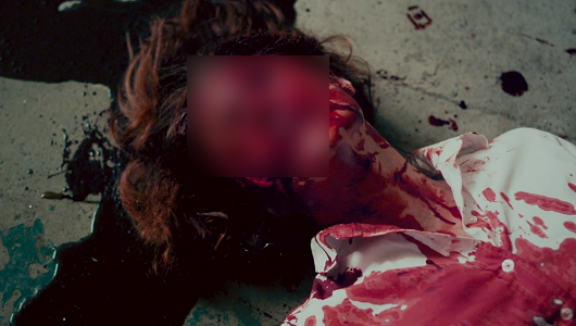 顔食われた女子アナ